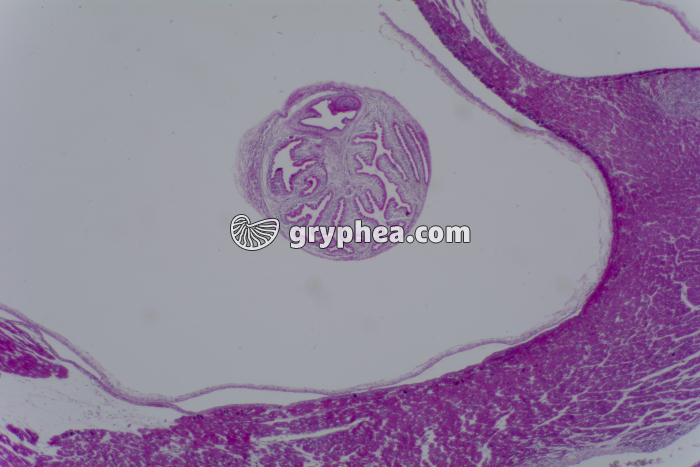 Coupe de muscle ladre (cystic - gryphea.org